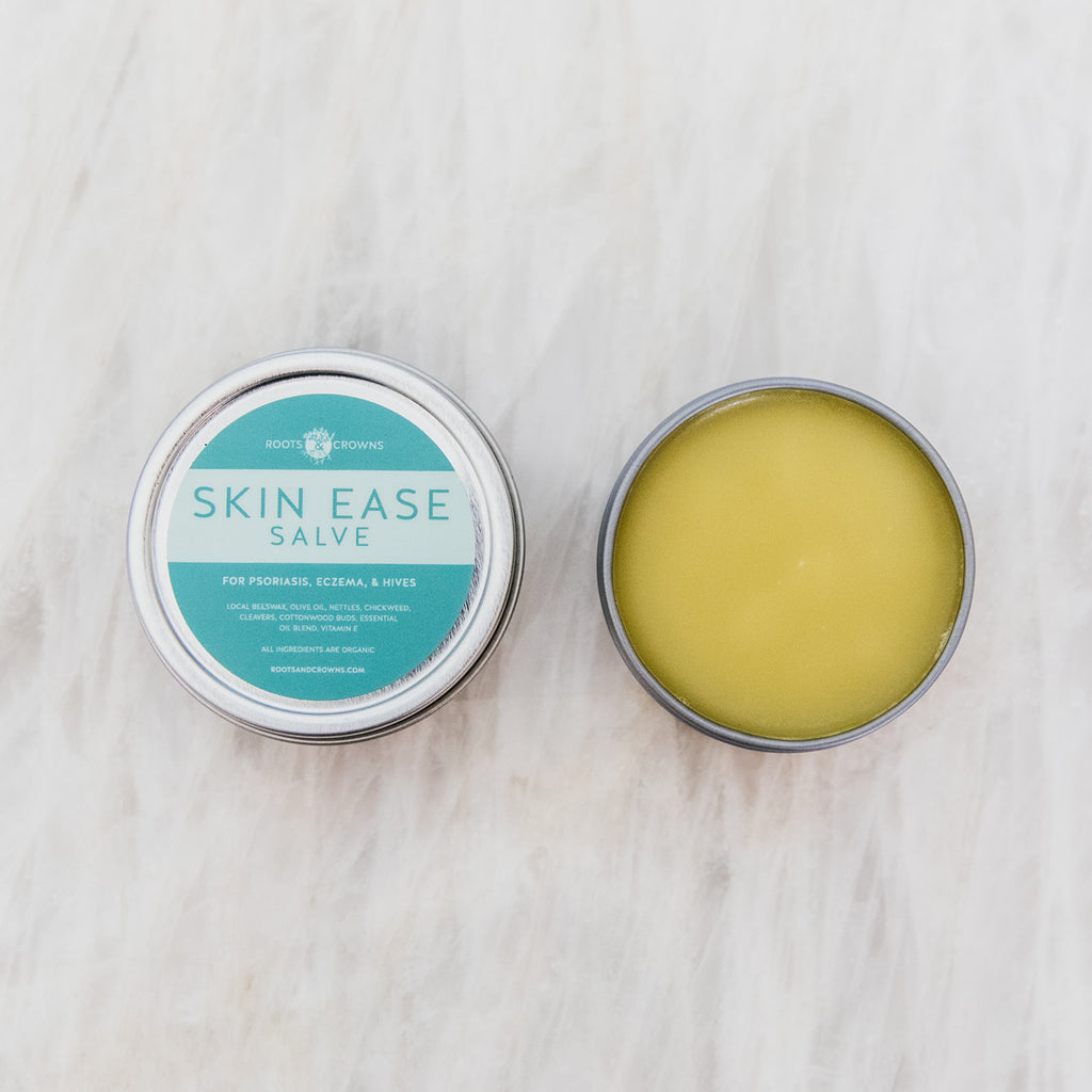 Skin Ease Salve: Formulated for Eczema, Psoriasis, Hives